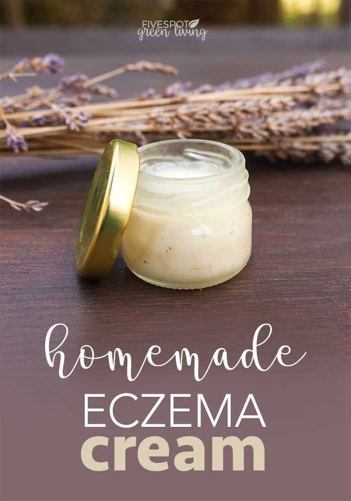 Homemade Eczema Cream Recipe for Dry Winter Skin