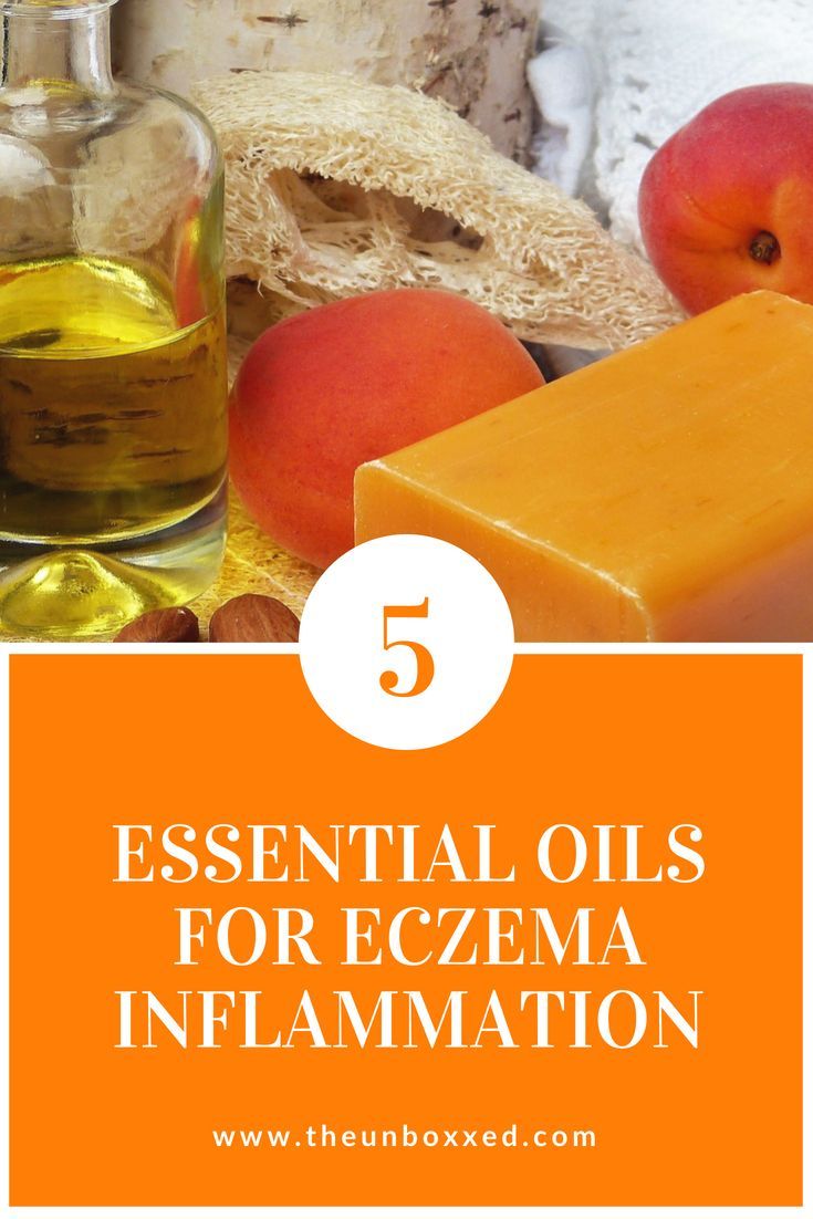 The UnboXXed: 5 Essential Oils for Eczema Inflammation